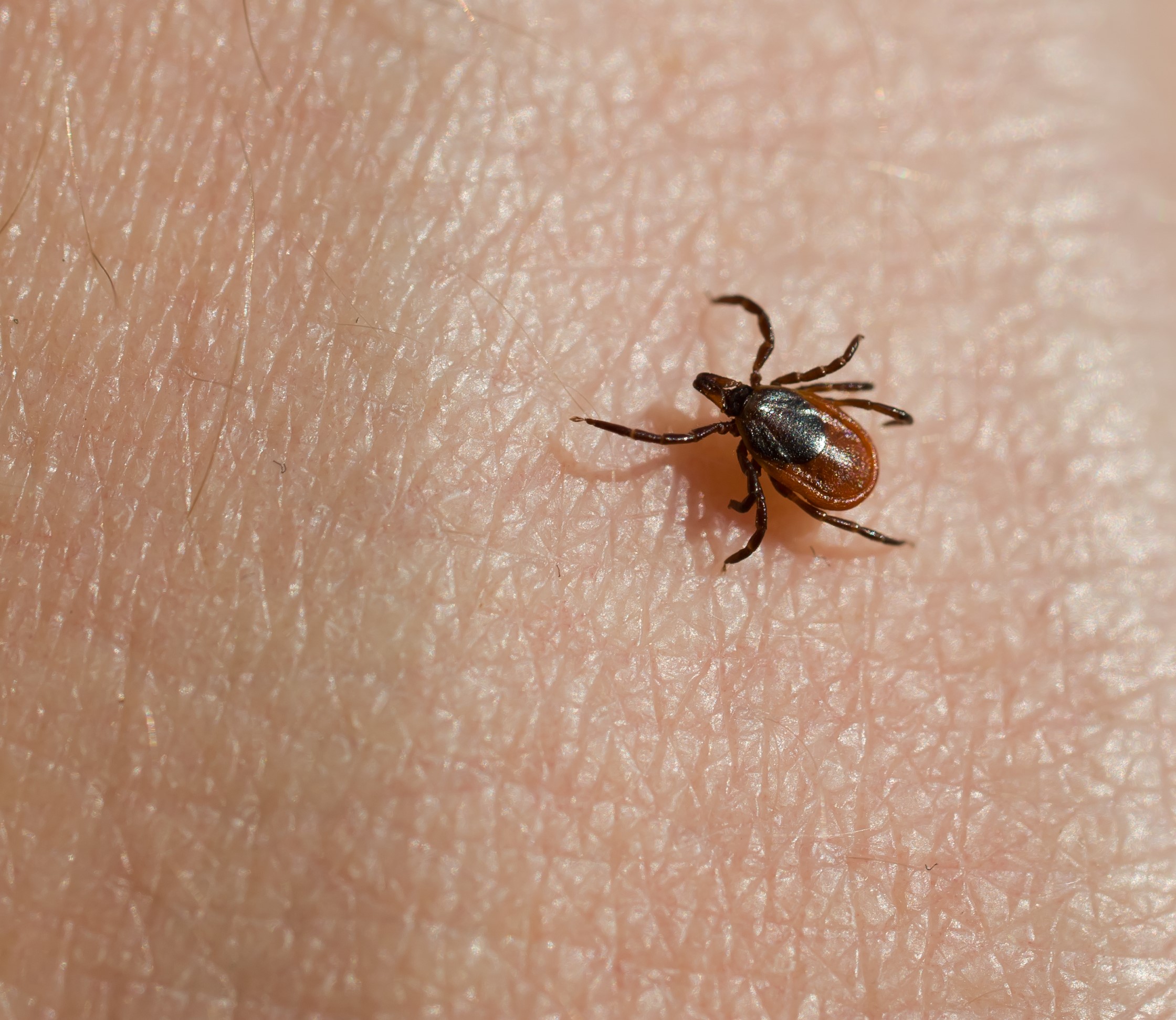 tick diseases