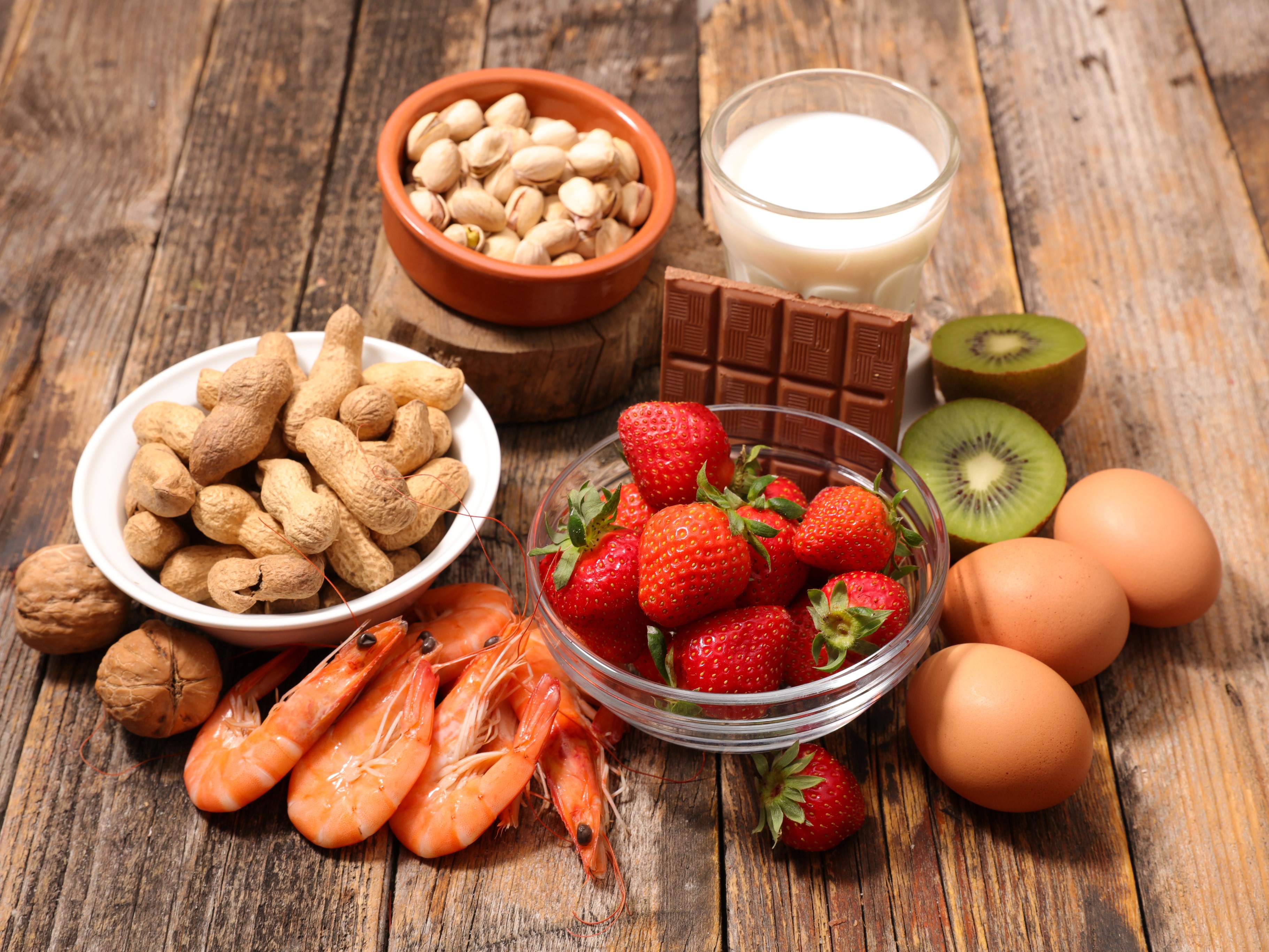 Display of food allergens including nuts, dairy, shellfish, eggs, and strawberries.